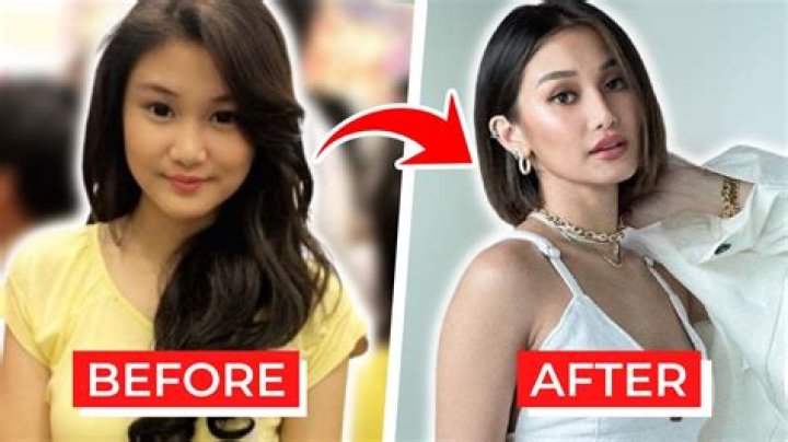 Did Chienna Filomeno Get A Nose Surgery? Filipino Actress Before And After Pictures Revealed