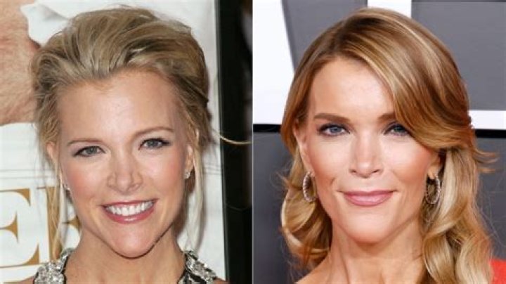 Did Kelly Mi Li Plastic Surgery? Here Is Why The Bling Empire Star Looks So Different Now