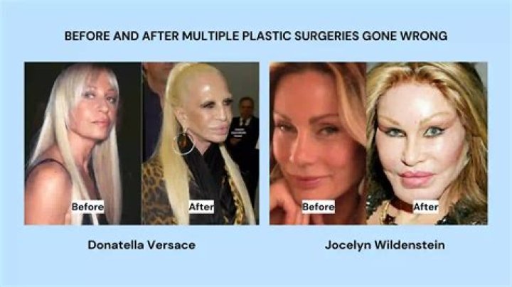Did Tia Carrere Plastic Surgery Go Wrong, Before And After Photos