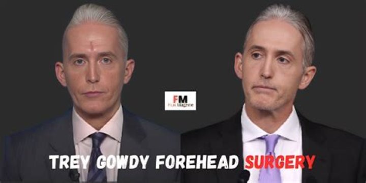 Did Trey Gowdy Get Plastic Surgery? Here Is Why The Former Politician Looks So Different