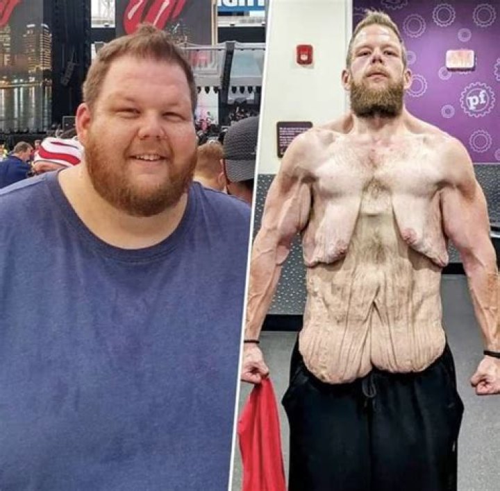 How Did Gerard Way Lose 40 Pounds? Weight Loss Journey From Fat To Fit