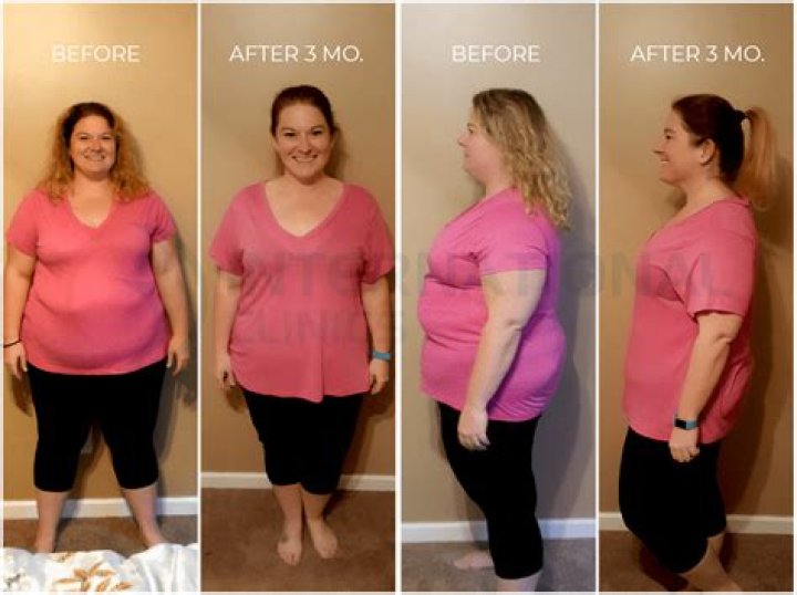 How Much Weight Did Morgan Stewart Lose? Here Are Before And After Pictures