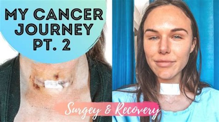 Joyce Vance Thyroid and Neck Surgery Update, Makeover 2022 and Health Update