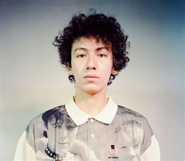 What Happened To Sub Urban Face | Has He Done Plastic Surgery